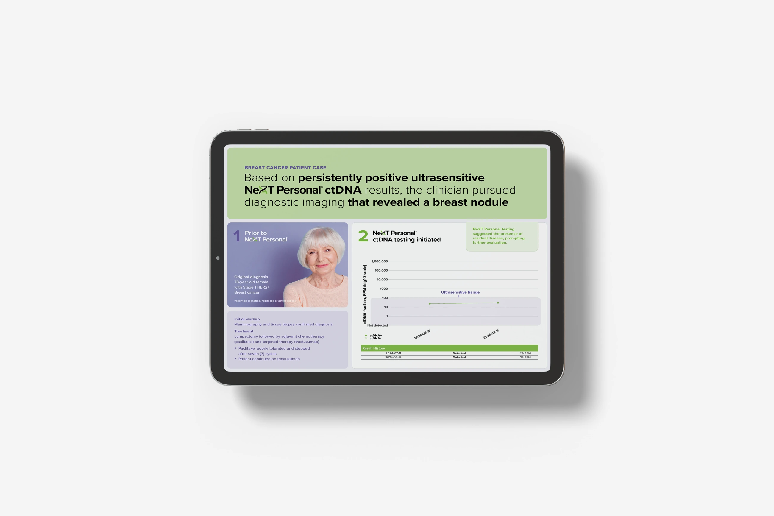 Personalis patient case presentation shown on a tablet